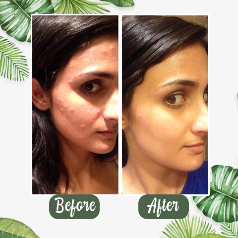 ๐๐ฏ๐จ๐๐ฏ๐จยฎ ๐๐ผ๐น๐ ๐๐ฎ๐๐ถ๐น ๐๐๐ฏ๐ฏ๐น๐ฒ ๐๐ฒ๐ฒ๐ฝ ๐ ๐ฎ๐๐ธ ๐ญ๐ฏ% | elasticity, hydrating, firming and moisturizing | ๐๐จ๐ซ๐๐๐ง ๐๐ค๐ข๐ง๐๐๐ซ๐