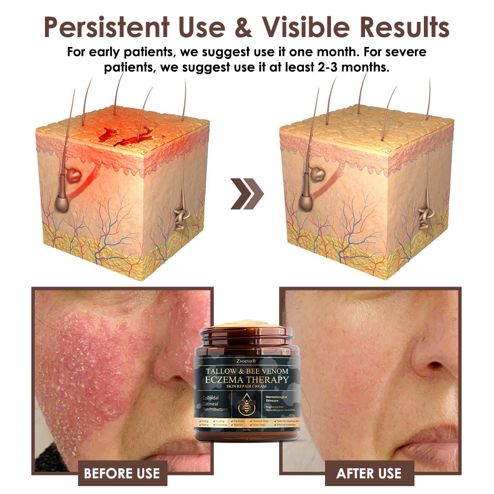 ๐บ๐ธ๐๐๐ฎ๐ฟ๐ฎ๐ป๐๐ฒ๐ฒ๐ฑ ๐ป๐ผ ๐ฟ๐ฒ๐ฐ๐๐ฟ๐ฟ๐ฒ๐ป๐ฐ๐ฒ๐ฟ๐๐ฏ๐จ๐๐ฏ๐จยฎ ๐๐๐ฅ๐ฅ๐จ๐ฐ ๐๐๐ ๐๐๐ง๐จ๐ฆ ๐๐ค๐ข๐ง ๐๐๐ฌ๐ญ๐จ๐ซ๐๐ญ๐ข๐จ๐ง ๐๐ซ๐๐๐ฆ๐บ๐ธ๐ ๐ฎ๐ฑ๐ฒ ๐๐ป ๐จ๐ฆ๐