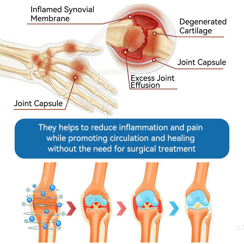𝐟𝐥𝐲𝐬𝐦𝐮𝐬® 𝐁𝐏𝐂-𝟏𝟓𝟕 𝐉𝐨𝐢𝐧𝐭 𝐇𝐞𝐚𝐥𝐢𝐧𝐠 𝐂𝐫𝐞𝐚𝐦🦴Treats Arthritis, Neuropathy, Rheumatism, Sports Injuries & More🏆