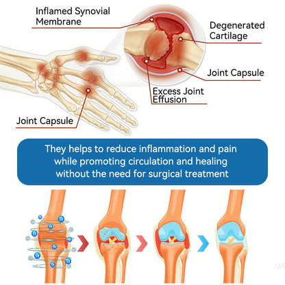 𝐟𝐥𝐲𝐬𝐦𝐮𝐬® 𝐁𝐏𝐂-𝟏𝟓𝟕 𝐉𝐨𝐢𝐧𝐭 𝐇𝐞𝐚𝐥𝐢𝐧𝐠 𝐂𝐫𝐞𝐚𝐦🦴Treats Arthritis, Neuropathy, Rheumatism, Sports Injuries & More🏆