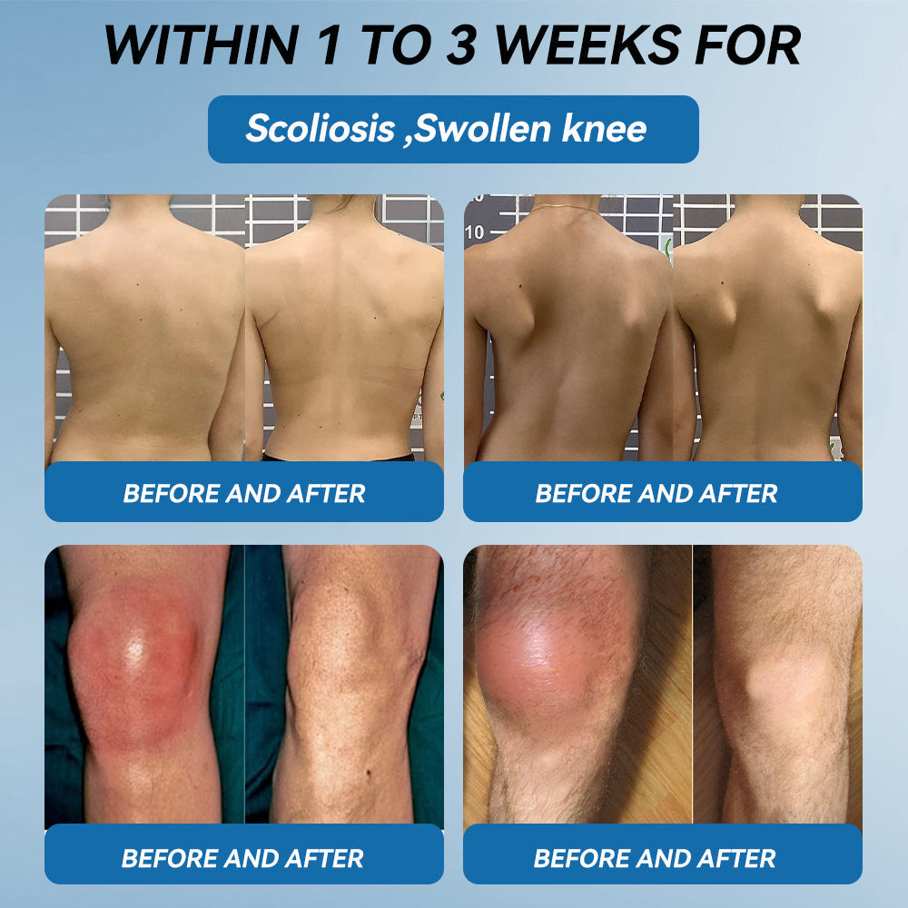 𝐟𝐥𝐲𝐬𝐦𝐮𝐬® 𝐁𝐏𝐂-𝟏𝟓𝟕 𝐉𝐨𝐢𝐧𝐭 𝐇𝐞𝐚𝐥𝐢𝐧𝐠 𝐂𝐫𝐞𝐚𝐦🦴Treats Arthritis, Neuropathy, Rheumatism, Sports Injuries & More🏆