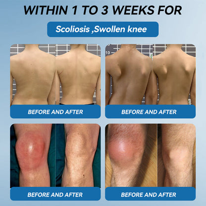 𝐟𝐥𝐲𝐬𝐦𝐮𝐬® 𝐁𝐏𝐂-𝟏𝟓𝟕 𝐉𝐨𝐢𝐧𝐭 𝐇𝐞𝐚𝐥𝐢𝐧𝐠 𝐂𝐫𝐞𝐚𝐦🦴Treats Arthritis, Neuropathy, Rheumatism, Sports Injuries & More🏆