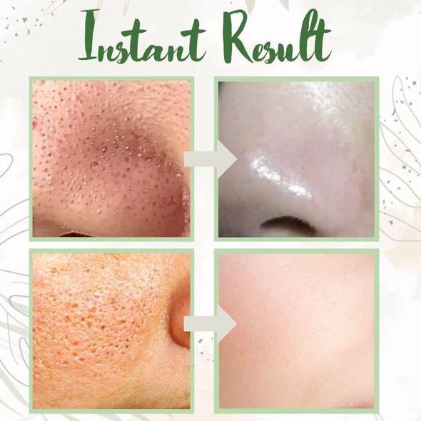 𝐙𝐯𝐨𝐞𝐯𝐨® 𝗛𝗼𝗹𝘆 𝗕𝗮𝘀𝗶𝗹 𝗕𝘂𝗯𝗯𝗹𝗲 𝗗𝗲𝗲𝗽 𝗠𝗮𝘀𝗸 𝟭𝟯% | elasticity, hydrating, firming and moisturizing | Made in 𝐊𝐨𝐫𝐞𝐚𝐧