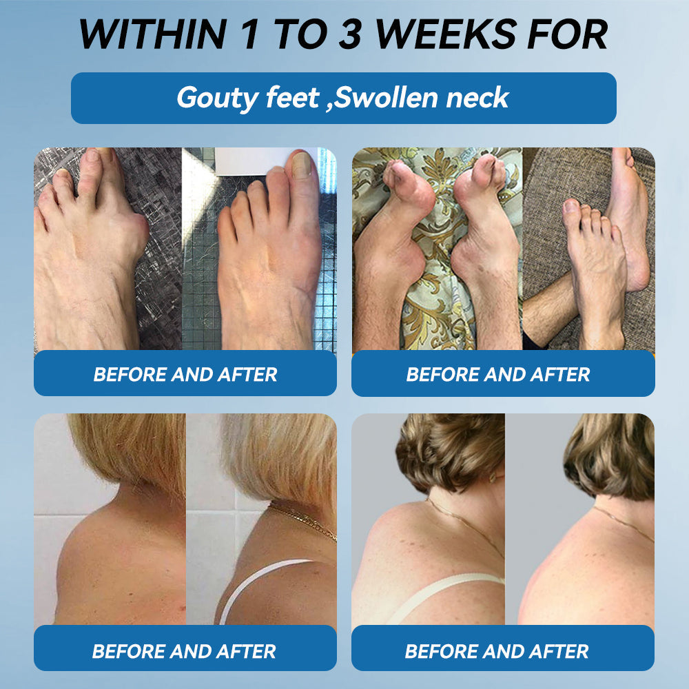 𝐟𝐥𝐲𝐬𝐦𝐮𝐬® 𝐁𝐏𝐂-𝟏𝟓𝟕 𝐉𝐨𝐢𝐧𝐭 𝐇𝐞𝐚𝐥𝐢𝐧𝐠 𝐂𝐫𝐞𝐚𝐦🦴Treats Arthritis, Neuropathy, Rheumatism, Sports Injuries & More🏆