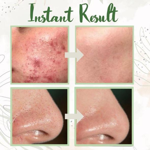 𝐙𝐯𝐨𝐞𝐯𝐨® 𝗛𝗼𝗹𝘆 𝗕𝗮𝘀𝗶𝗹 𝗕𝘂𝗯𝗯𝗹𝗲 𝗗𝗲𝗲𝗽 𝗠𝗮𝘀𝗸 𝟭𝟯% | elasticity, hydrating, firming and moisturizing | Made in 𝐊𝐨𝐫𝐞𝐚𝐧