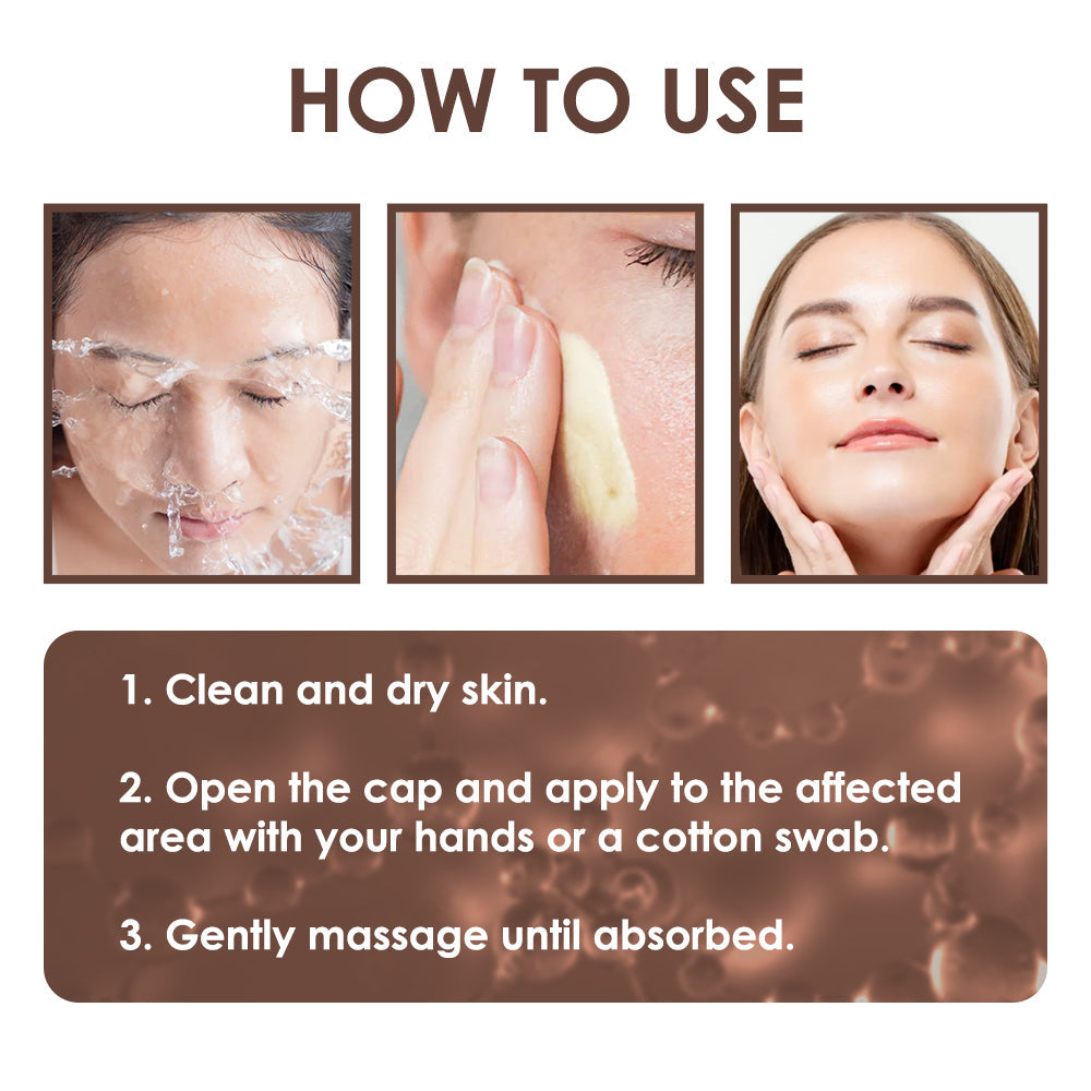 🇺🇸 𝐅𝐃𝐀 𝐎𝐟𝐟𝐢𝐜𝐢𝐚𝐥: 𝐙𝐯𝐨𝐞𝐯𝐨® 𝐓𝐚𝐥𝐥𝐨𝐰 𝐁𝐞𝐞 𝐕𝐞𝐧𝐨𝐦 𝐒𝐤𝐢𝐧 𝐑𝐞𝐬𝐭𝐨𝐫𝐚𝐭𝐢𝐨𝐧 𝐂𝐫𝐞𝐚𝐦 - 𝐀𝐧𝐭𝐢-𝐚𝐠𝐢𝐧𝐠, 𝐇𝐲𝐝𝐫𝐚𝐭𝐢𝐧𝐠, 𝐒𝐤𝐢𝐧 𝐅𝐢𝐫𝐦𝐢𝐧𝐠 & 𝐋𝐢𝐟𝐭𝐢𝐧𝐠, 𝐒𝐤𝐢𝐧 𝐑𝐞𝐩𝐚𝐢𝐫, 𝐄𝐯𝐞𝐧 𝐓𝐨𝐧𝐞, 𝐀𝐜𝐧𝐞 𝐚𝐧𝐝 𝐃𝐚𝐫𝐤 𝐒𝐩𝐨𝐭 𝐓𝐫𝐞𝐚𝐭𝐦𝐞𝐧𝐭, 𝐖𝐚𝐫𝐭 𝐚𝐧𝐝 𝐌𝐨𝐥𝐞 𝐑𝐞𝐦𝐨𝐯𝐚𝐥, 𝐚𝐧𝐝 𝐏𝐬𝐨𝐫𝐢𝐚𝐬𝐢𝐬 𝐑𝐞𝐥𝐢𝐞𝐟.