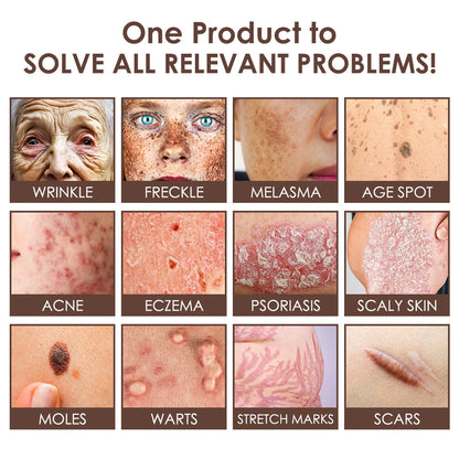 🇺🇸 𝐅𝐃𝐀 𝐎𝐟𝐟𝐢𝐜𝐢𝐚𝐥: 𝐙𝐯𝐨𝐞𝐯𝐨® 𝐓𝐚𝐥𝐥𝐨𝐰 𝐁𝐞𝐞 𝐕𝐞𝐧𝐨𝐦 𝐒𝐤𝐢𝐧 𝐑𝐞𝐬𝐭𝐨𝐫𝐚𝐭𝐢𝐨𝐧 𝐂𝐫𝐞𝐚𝐦 - 𝐀𝐧𝐭𝐢-𝐚𝐠𝐢𝐧𝐠, 𝐇𝐲𝐝𝐫𝐚𝐭𝐢𝐧𝐠, 𝐒𝐤𝐢𝐧 𝐅𝐢𝐫𝐦𝐢𝐧𝐠 & 𝐋𝐢𝐟𝐭𝐢𝐧𝐠, 𝐒𝐤𝐢𝐧 𝐑𝐞𝐩𝐚𝐢𝐫, 𝐄𝐯𝐞𝐧 𝐓𝐨𝐧𝐞, 𝐀𝐜𝐧𝐞 𝐚𝐧𝐝 𝐃𝐚𝐫𝐤 𝐒𝐩𝐨𝐭 𝐓𝐫𝐞𝐚𝐭𝐦𝐞𝐧𝐭, 𝐖𝐚𝐫𝐭 𝐚𝐧𝐝 𝐌𝐨𝐥𝐞 𝐑𝐞𝐦𝐨𝐯𝐚𝐥, 𝐚𝐧𝐝 𝐏𝐬𝐨𝐫𝐢𝐚𝐬𝐢𝐬 𝐑𝐞𝐥𝐢𝐞𝐟.