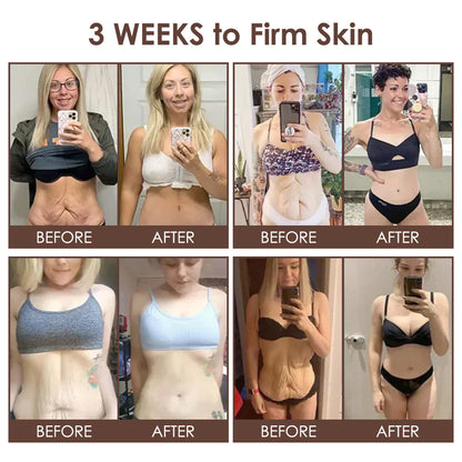 🇺🇸 𝐅𝐃𝐀 𝐎𝐟𝐟𝐢𝐜𝐢𝐚𝐥: 𝐙𝐯𝐨𝐞𝐯𝐨® 𝐓𝐚𝐥𝐥𝐨𝐰 𝐁𝐞𝐞 𝐕𝐞𝐧𝐨𝐦 𝐒𝐤𝐢𝐧 𝐑𝐞𝐬𝐭𝐨𝐫𝐚𝐭𝐢𝐨𝐧 𝐂𝐫𝐞𝐚𝐦 - 𝐀𝐧𝐭𝐢-𝐚𝐠𝐢𝐧𝐠, 𝐇𝐲𝐝𝐫𝐚𝐭𝐢𝐧𝐠, 𝐒𝐤𝐢𝐧 𝐅𝐢𝐫𝐦𝐢𝐧𝐠 & 𝐋𝐢𝐟𝐭𝐢𝐧𝐠, 𝐒𝐤𝐢𝐧 𝐑𝐞𝐩𝐚𝐢𝐫, 𝐄𝐯𝐞𝐧 𝐓𝐨𝐧𝐞, 𝐀𝐜𝐧𝐞 𝐚𝐧𝐝 𝐃𝐚𝐫𝐤 𝐒𝐩𝐨𝐭 𝐓𝐫𝐞𝐚𝐭𝐦𝐞𝐧𝐭, 𝐖𝐚𝐫𝐭 𝐚𝐧𝐝 𝐌𝐨𝐥𝐞 𝐑𝐞𝐦𝐨𝐯𝐚𝐥, 𝐚𝐧𝐝 𝐏𝐬𝐨𝐫𝐢𝐚𝐬𝐢𝐬 𝐑𝐞𝐥𝐢𝐞𝐟.