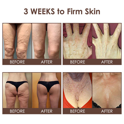 🇺🇸 𝐅𝐃𝐀 𝐎𝐟𝐟𝐢𝐜𝐢𝐚𝐥: 𝐙𝐯𝐨𝐞𝐯𝐨® 𝐓𝐚𝐥𝐥𝐨𝐰 𝐁𝐞𝐞 𝐕𝐞𝐧𝐨𝐦 𝐒𝐤𝐢𝐧 𝐑𝐞𝐬𝐭𝐨𝐫𝐚𝐭𝐢𝐨𝐧 𝐂𝐫𝐞𝐚𝐦 - 𝐀𝐧𝐭𝐢-𝐚𝐠𝐢𝐧𝐠, 𝐇𝐲𝐝𝐫𝐚𝐭𝐢𝐧𝐠, 𝐒𝐤𝐢𝐧 𝐅𝐢𝐫𝐦𝐢𝐧𝐠 & 𝐋𝐢𝐟𝐭𝐢𝐧𝐠, 𝐒𝐤𝐢𝐧 𝐑𝐞𝐩𝐚𝐢𝐫, 𝐄𝐯𝐞𝐧 𝐓𝐨𝐧𝐞, 𝐀𝐜𝐧𝐞 𝐚𝐧𝐝 𝐃𝐚𝐫𝐤 𝐒𝐩𝐨𝐭 𝐓𝐫𝐞𝐚𝐭𝐦𝐞𝐧𝐭, 𝐖𝐚𝐫𝐭 𝐚𝐧𝐝 𝐌𝐨𝐥𝐞 𝐑𝐞𝐦𝐨𝐯𝐚𝐥, 𝐚𝐧𝐝 𝐏𝐬𝐨𝐫𝐢𝐚𝐬𝐢𝐬 𝐑𝐞𝐥𝐢𝐞𝐟.