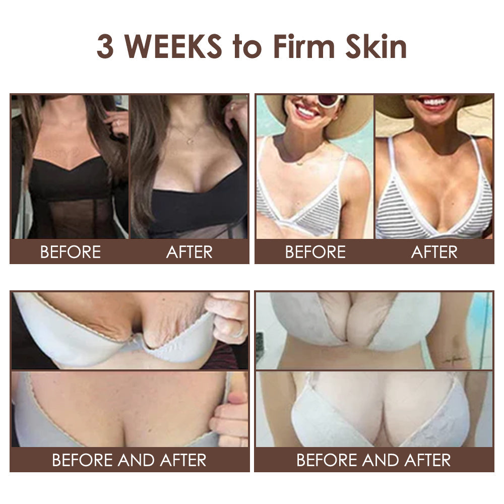 🇺🇸 𝐅𝐃𝐀 𝐎𝐟𝐟𝐢𝐜𝐢𝐚𝐥: 𝐙𝐯𝐨𝐞𝐯𝐨® 𝐓𝐚𝐥𝐥𝐨𝐰 𝐁𝐞𝐞 𝐕𝐞𝐧𝐨𝐦 𝐒𝐤𝐢𝐧 𝐑𝐞𝐬𝐭𝐨𝐫𝐚𝐭𝐢𝐨𝐧 𝐂𝐫𝐞𝐚𝐦 - 𝐀𝐧𝐭𝐢-𝐚𝐠𝐢𝐧𝐠, 𝐇𝐲𝐝𝐫𝐚𝐭𝐢𝐧𝐠, 𝐒𝐤𝐢𝐧 𝐅𝐢𝐫𝐦𝐢𝐧𝐠 & 𝐋𝐢𝐟𝐭𝐢𝐧𝐠, 𝐒𝐤𝐢𝐧 𝐑𝐞𝐩𝐚𝐢𝐫, 𝐄𝐯𝐞𝐧 𝐓𝐨𝐧𝐞, 𝐀𝐜𝐧𝐞 𝐚𝐧𝐝 𝐃𝐚𝐫𝐤 𝐒𝐩𝐨𝐭 𝐓𝐫𝐞𝐚𝐭𝐦𝐞𝐧𝐭, 𝐖𝐚𝐫𝐭 𝐚𝐧𝐝 𝐌𝐨𝐥𝐞 𝐑𝐞𝐦𝐨𝐯𝐚𝐥, 𝐚𝐧𝐝 𝐏𝐬𝐨𝐫𝐢𝐚𝐬𝐢𝐬 𝐑𝐞𝐥𝐢𝐞𝐟.