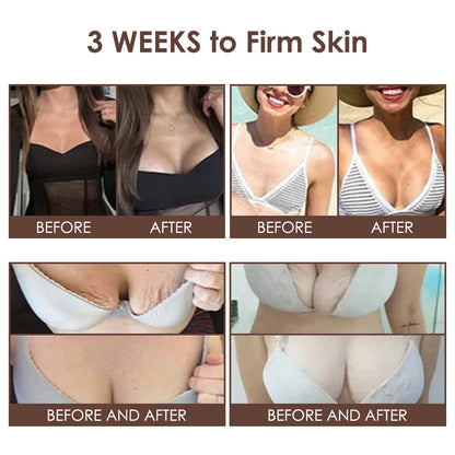 🇺🇸 𝐅𝐃𝐀 𝐎𝐟𝐟𝐢𝐜𝐢𝐚𝐥: 𝐙𝐯𝐨𝐞𝐯𝐨® 𝐓𝐚𝐥𝐥𝐨𝐰 𝐁𝐞𝐞 𝐕𝐞𝐧𝐨𝐦 𝐒𝐤𝐢𝐧 𝐑𝐞𝐬𝐭𝐨𝐫𝐚𝐭𝐢𝐨𝐧 𝐂𝐫𝐞𝐚𝐦 - 𝐀𝐧𝐭𝐢-𝐚𝐠𝐢𝐧𝐠, 𝐇𝐲𝐝𝐫𝐚𝐭𝐢𝐧𝐠, 𝐒𝐤𝐢𝐧 𝐅𝐢𝐫𝐦𝐢𝐧𝐠 & 𝐋𝐢𝐟𝐭𝐢𝐧𝐠, 𝐒𝐤𝐢𝐧 𝐑𝐞𝐩𝐚𝐢𝐫, 𝐄𝐯𝐞𝐧 𝐓𝐨𝐧𝐞, 𝐀𝐜𝐧𝐞 𝐚𝐧𝐝 𝐃𝐚𝐫𝐤 𝐒𝐩𝐨𝐭 𝐓𝐫𝐞𝐚𝐭𝐦𝐞𝐧𝐭, 𝐖𝐚𝐫𝐭 𝐚𝐧𝐝 𝐌𝐨𝐥𝐞 𝐑𝐞𝐦𝐨𝐯𝐚𝐥, 𝐚𝐧𝐝 𝐏𝐬𝐨𝐫𝐢𝐚𝐬𝐢𝐬 𝐑𝐞𝐥𝐢𝐞𝐟.