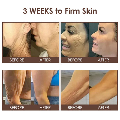 🇺🇸 𝐅𝐃𝐀 𝐎𝐟𝐟𝐢𝐜𝐢𝐚𝐥: 𝐙𝐯𝐨𝐞𝐯𝐨® 𝐓𝐚𝐥𝐥𝐨𝐰 𝐁𝐞𝐞 𝐕𝐞𝐧𝐨𝐦 𝐒𝐤𝐢𝐧 𝐑𝐞𝐬𝐭𝐨𝐫𝐚𝐭𝐢𝐨𝐧 𝐂𝐫𝐞𝐚𝐦 - 𝐀𝐧𝐭𝐢-𝐚𝐠𝐢𝐧𝐠, 𝐇𝐲𝐝𝐫𝐚𝐭𝐢𝐧𝐠, 𝐒𝐤𝐢𝐧 𝐅𝐢𝐫𝐦𝐢𝐧𝐠 & 𝐋𝐢𝐟𝐭𝐢𝐧𝐠, 𝐒𝐤𝐢𝐧 𝐑𝐞𝐩𝐚𝐢𝐫, 𝐄𝐯𝐞𝐧 𝐓𝐨𝐧𝐞, 𝐀𝐜𝐧𝐞 𝐚𝐧𝐝 𝐃𝐚𝐫𝐤 𝐒𝐩𝐨𝐭 𝐓𝐫𝐞𝐚𝐭𝐦𝐞𝐧𝐭, 𝐖𝐚𝐫𝐭 𝐚𝐧𝐝 𝐌𝐨𝐥𝐞 𝐑𝐞𝐦𝐨𝐯𝐚𝐥, 𝐚𝐧𝐝 𝐏𝐬𝐨𝐫𝐢𝐚𝐬𝐢𝐬 𝐑𝐞𝐥𝐢𝐞𝐟.