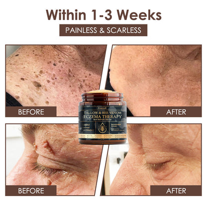 🇺🇸 𝐅𝐃𝐀 𝐎𝐟𝐟𝐢𝐜𝐢𝐚𝐥: 𝐙𝐯𝐨𝐞𝐯𝐨® 𝐓𝐚𝐥𝐥𝐨𝐰 𝐁𝐞𝐞 𝐕𝐞𝐧𝐨𝐦 𝐒𝐤𝐢𝐧 𝐑𝐞𝐬𝐭𝐨𝐫𝐚𝐭𝐢𝐨𝐧 𝐂𝐫𝐞𝐚𝐦 - 𝐀𝐧𝐭𝐢-𝐚𝐠𝐢𝐧𝐠, 𝐇𝐲𝐝𝐫𝐚𝐭𝐢𝐧𝐠, 𝐒𝐤𝐢𝐧 𝐅𝐢𝐫𝐦𝐢𝐧𝐠 & 𝐋𝐢𝐟𝐭𝐢𝐧𝐠, 𝐒𝐤𝐢𝐧 𝐑𝐞𝐩𝐚𝐢𝐫, 𝐄𝐯𝐞𝐧 𝐓𝐨𝐧𝐞, 𝐀𝐜𝐧𝐞 𝐚𝐧𝐝 𝐃𝐚𝐫𝐤 𝐒𝐩𝐨𝐭 𝐓𝐫𝐞𝐚𝐭𝐦𝐞𝐧𝐭, 𝐖𝐚𝐫𝐭 𝐚𝐧𝐝 𝐌𝐨𝐥𝐞 𝐑𝐞𝐦𝐨𝐯𝐚𝐥, 𝐚𝐧𝐝 𝐏𝐬𝐨𝐫𝐢𝐚𝐬𝐢𝐬 𝐑𝐞𝐥𝐢𝐞𝐟.