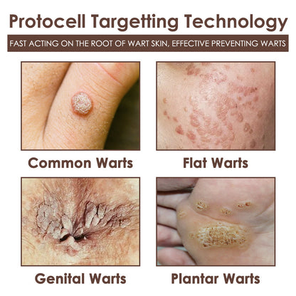 🇺🇸 𝐅𝐃𝐀 𝐎𝐟𝐟𝐢𝐜𝐢𝐚𝐥: 𝐙𝐯𝐨𝐞𝐯𝐨® 𝐓𝐚𝐥𝐥𝐨𝐰 𝐁𝐞𝐞 𝐕𝐞𝐧𝐨𝐦 𝐒𝐤𝐢𝐧 𝐑𝐞𝐬𝐭𝐨𝐫𝐚𝐭𝐢𝐨𝐧 𝐂𝐫𝐞𝐚𝐦 - 𝐀𝐧𝐭𝐢-𝐚𝐠𝐢𝐧𝐠, 𝐇𝐲𝐝𝐫𝐚𝐭𝐢𝐧𝐠, 𝐒𝐤𝐢𝐧 𝐅𝐢𝐫𝐦𝐢𝐧𝐠 & 𝐋𝐢𝐟𝐭𝐢𝐧𝐠, 𝐒𝐤𝐢𝐧 𝐑𝐞𝐩𝐚𝐢𝐫, 𝐄𝐯𝐞𝐧 𝐓𝐨𝐧𝐞, 𝐀𝐜𝐧𝐞 𝐚𝐧𝐝 𝐃𝐚𝐫𝐤 𝐒𝐩𝐨𝐭 𝐓𝐫𝐞𝐚𝐭𝐦𝐞𝐧𝐭, 𝐖𝐚𝐫𝐭 𝐚𝐧𝐝 𝐌𝐨𝐥𝐞 𝐑𝐞𝐦𝐨𝐯𝐚𝐥, 𝐚𝐧𝐝 𝐏𝐬𝐨𝐫𝐢𝐚𝐬𝐢𝐬 𝐑𝐞𝐥𝐢𝐞𝐟.