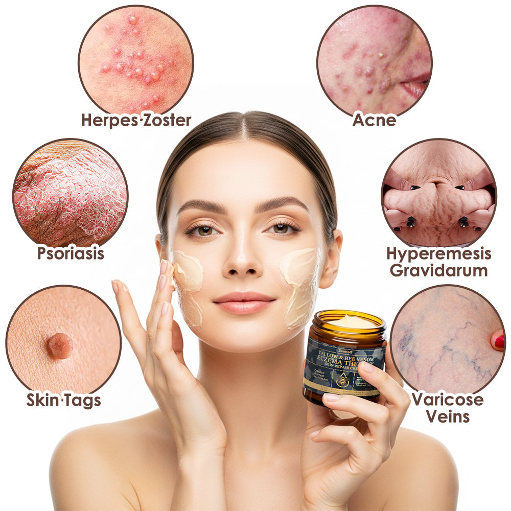 🇺🇸 𝐅𝐃𝐀 𝐎𝐟𝐟𝐢𝐜𝐢𝐚𝐥: 𝐙𝐯𝐨𝐞𝐯𝐨® 𝐓𝐚𝐥𝐥𝐨𝐰 𝐁𝐞𝐞 𝐕𝐞𝐧𝐨𝐦 𝐒𝐤𝐢𝐧 𝐑𝐞𝐬𝐭𝐨𝐫𝐚𝐭𝐢𝐨𝐧 𝐂𝐫𝐞𝐚𝐦 - 𝐀𝐧𝐭𝐢-𝐚𝐠𝐢𝐧𝐠, 𝐇𝐲𝐝𝐫𝐚𝐭𝐢𝐧𝐠, 𝐒𝐤𝐢𝐧 𝐅𝐢𝐫𝐦𝐢𝐧𝐠 & 𝐋𝐢𝐟𝐭𝐢𝐧𝐠, 𝐒𝐤𝐢𝐧 𝐑𝐞𝐩𝐚𝐢𝐫, 𝐄𝐯𝐞𝐧 𝐓𝐨𝐧𝐞, 𝐀𝐜𝐧𝐞 𝐚𝐧𝐝 𝐃𝐚𝐫𝐤 𝐒𝐩𝐨𝐭 𝐓𝐫𝐞𝐚𝐭𝐦𝐞𝐧𝐭, 𝐖𝐚𝐫𝐭 𝐚𝐧𝐝 𝐌𝐨𝐥𝐞 𝐑𝐞𝐦𝐨𝐯𝐚𝐥, 𝐚𝐧𝐝 𝐏𝐬𝐨𝐫𝐢𝐚𝐬𝐢𝐬 𝐑𝐞𝐥𝐢𝐞𝐟.