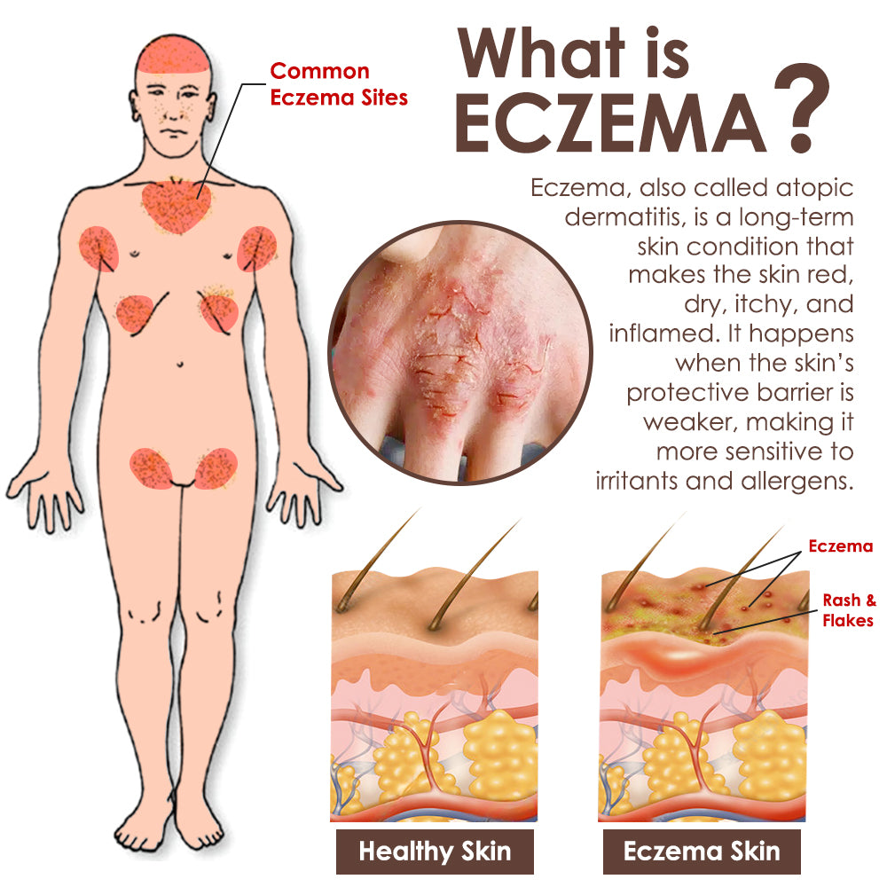 🇺🇸𝗚𝘂𝗮𝗿𝗮𝗻𝘁𝗲𝗲𝗱 𝗻𝗼 𝗿𝗲𝗰𝘂𝗿𝗿𝗲𝗻𝗰𝗲🌿𝐙𝐯𝐨𝐞𝐯𝐨® 𝐓𝐚𝐥𝐥𝐨𝐰 𝐁𝐞𝐞 𝐕𝐞𝐧𝐨𝐦 𝐒𝐤𝐢𝐧 𝐑𝐞𝐬𝐭𝐨𝐫𝐚𝐭𝐢𝐨𝐧 𝐂𝐫𝐞𝐚𝐦🇺🇸𝗠𝗮𝗱𝗲 𝗜𝗻 𝗨𝗦𝗔