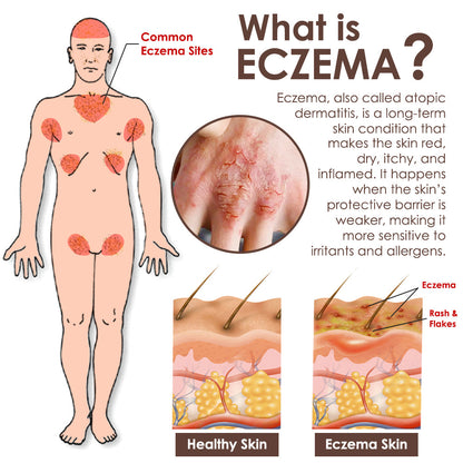 🇺🇸𝗚𝘂𝗮𝗿𝗮𝗻𝘁𝗲𝗲𝗱 𝗻𝗼 𝗿𝗲𝗰𝘂𝗿𝗿𝗲𝗻𝗰𝗲🌿𝐙𝐯𝐨𝐞𝐯𝐨® 𝐓𝐚𝐥𝐥𝐨𝐰 𝐁𝐞𝐞 𝐕𝐞𝐧𝐨𝐦 𝐒𝐤𝐢𝐧 𝐑𝐞𝐬𝐭𝐨𝐫𝐚𝐭𝐢𝐨𝐧 𝐂𝐫𝐞𝐚𝐦🇺🇸𝗠𝗮𝗱𝗲 𝗜𝗻 𝗨𝗦𝗔