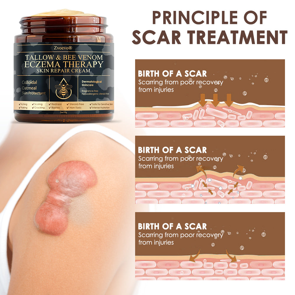 🇺🇸 𝐅𝐃𝐀 𝐎𝐟𝐟𝐢𝐜𝐢𝐚𝐥: 𝐙𝐯𝐨𝐞𝐯𝐨® 𝐓𝐚𝐥𝐥𝐨𝐰 𝐁𝐞𝐞 𝐕𝐞𝐧𝐨𝐦 𝐒𝐤𝐢𝐧 𝐑𝐞𝐬𝐭𝐨𝐫𝐚𝐭𝐢𝐨𝐧 𝐂𝐫𝐞𝐚𝐦 - 𝐀𝐧𝐭𝐢-𝐚𝐠𝐢𝐧𝐠, 𝐇𝐲𝐝𝐫𝐚𝐭𝐢𝐧𝐠, 𝐒𝐤𝐢𝐧 𝐅𝐢𝐫𝐦𝐢𝐧𝐠 & 𝐋𝐢𝐟𝐭𝐢𝐧𝐠, 𝐒𝐤𝐢𝐧 𝐑𝐞𝐩𝐚𝐢𝐫, 𝐄𝐯𝐞𝐧 𝐓𝐨𝐧𝐞, 𝐀𝐜𝐧𝐞 𝐚𝐧𝐝 𝐃𝐚𝐫𝐤 𝐒𝐩𝐨𝐭 𝐓𝐫𝐞𝐚𝐭𝐦𝐞𝐧𝐭, 𝐖𝐚𝐫𝐭 𝐚𝐧𝐝 𝐌𝐨𝐥𝐞 𝐑𝐞𝐦𝐨𝐯𝐚𝐥, 𝐚𝐧𝐝 𝐏𝐬𝐨𝐫𝐢𝐚𝐬𝐢𝐬 𝐑𝐞𝐥𝐢𝐞𝐟.